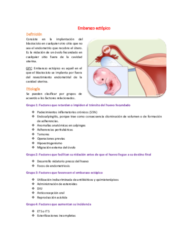 Miniatura del documento 24 Embarazo ectópico.pdf