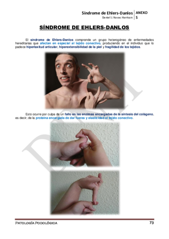 Miniatura del documento ANEXO-5o-Sindrome-de-Ehlers-Danlos.pdf