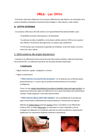 Miniatura del documento ORL6- Las Otitis.pdf