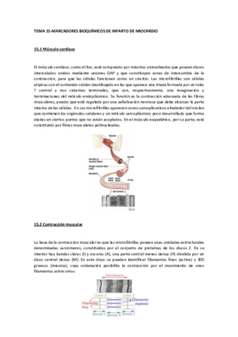Miniatura del documento TEMA 14-Marcadores bioquímicos de infarto de miocardio.pdf