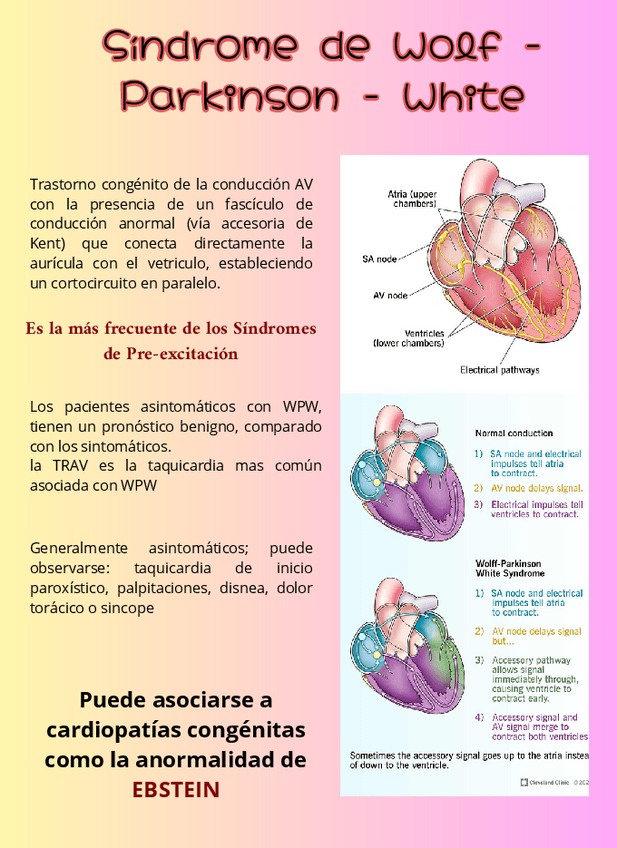 Miniatura del documento Sindrome-de-Wolf-Parkinson-White.pdf