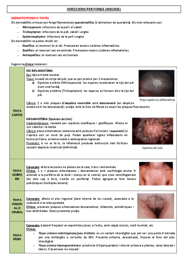 Miniatura del documento 7-INFECCIONS-FUNGIQUES.pdf