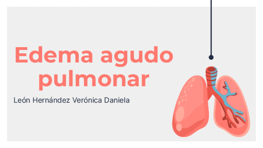 Miniatura del documento Edema-agudo-pulmonar.pdf