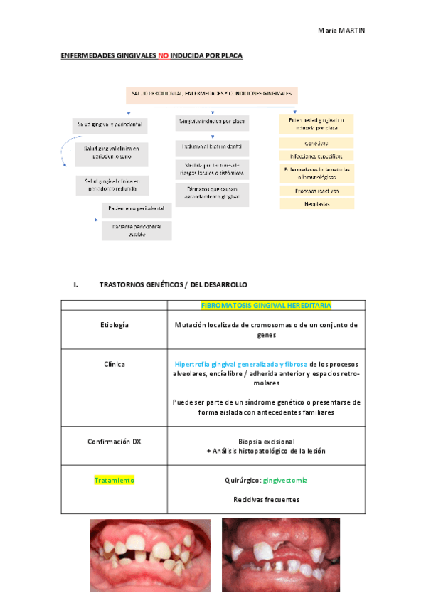 Miniatura del documento T9-GINGIVITIS-NO-INDUCIDA-POR-PLACA.pdf