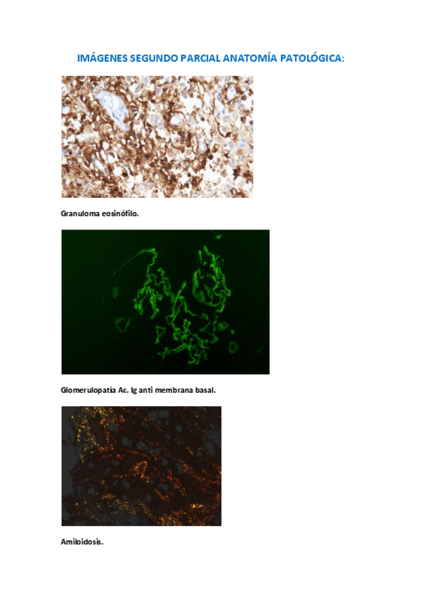 Miniatura del documento IMAGENES-SEGUNDO-PARCIAL-ANATOMIA-PATOLOGICA.pdf