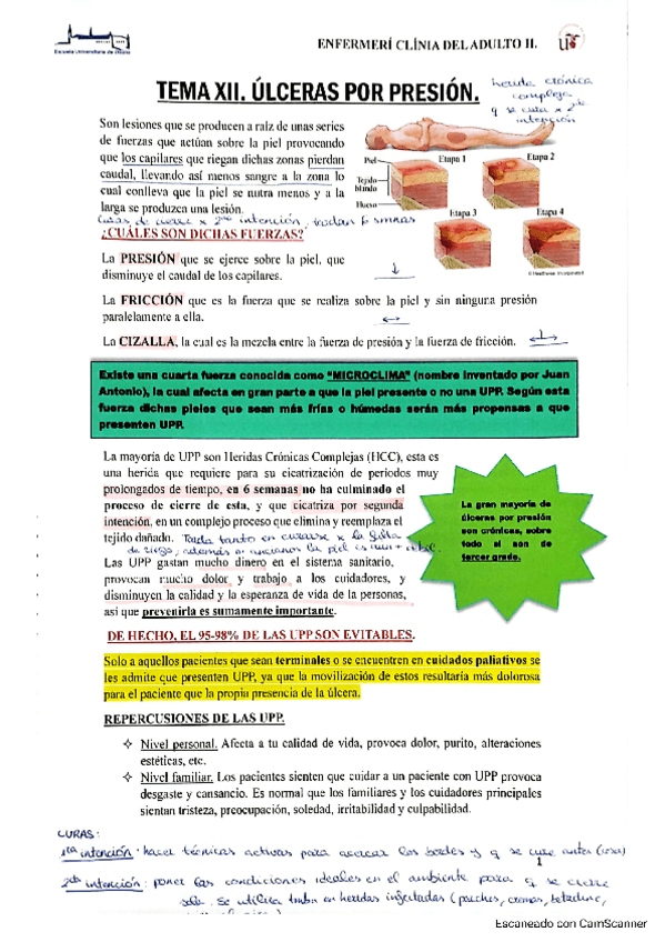 Miniatura del documento TEMA-12-ULCERAS-POR-PRESION.pdf