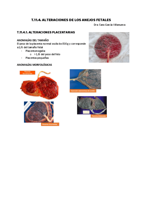 Miniatura del documento T.11.4.-ALTERACIONES-DE-LOS-ANEJOS-FETALES.pdf