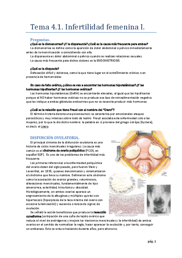 Miniatura del documento Tema 4.1. Infertilidad femenina.pdf
