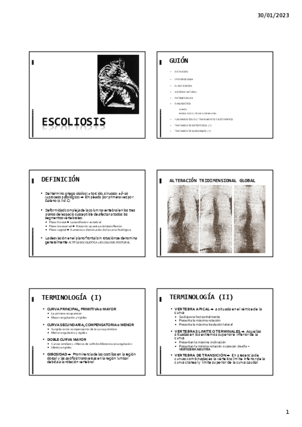 Miniatura del documento 3.-ESCOLIOSIS-I.pdf