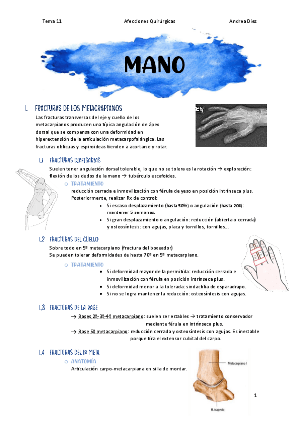 Miniatura del documento Tema-11-Mano.pdf