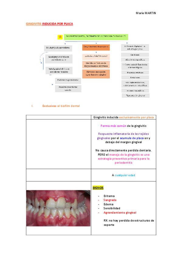 Miniatura del documento T12-GINGIVITIS-INDUCIDA-POR-PLACA.pdf
