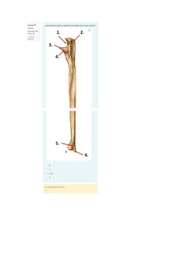 Miniatura del documento Solucion-Minitest-Osteo-Artrologia-del-miembro-Superior.pdf