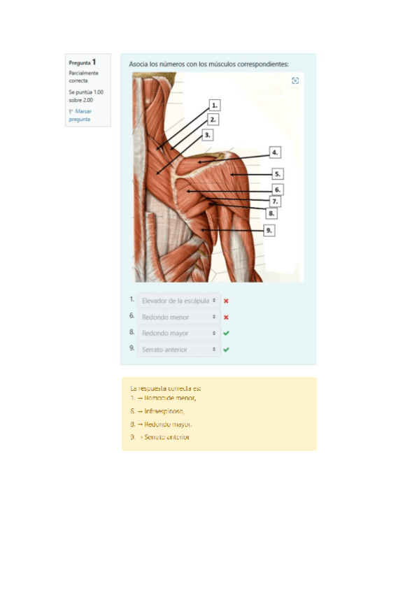 Miniatura del documento Solucion-Minitest-Musculos-de-la-cintura-escapular-y-del-brazo.pdf