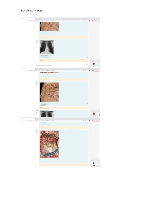 Miniatura del documento fotos-examenes.pdf