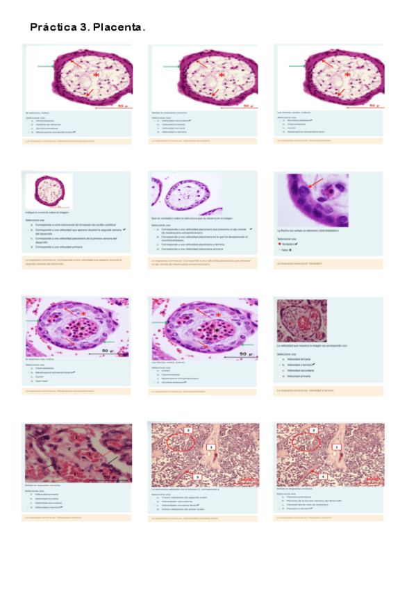 Miniatura del documento Cuestionario Práctica 3. Placenta.pdf