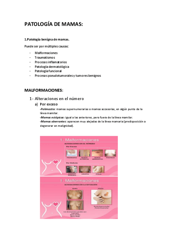 Miniatura del documento TEMA 5. Patología de mamas.pdf