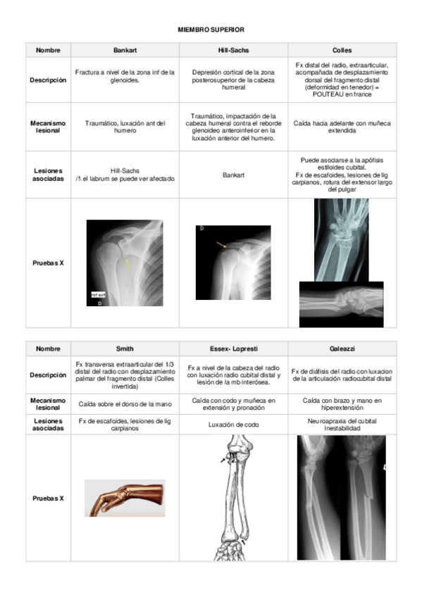 Miniatura del documento fracturas-nombres-propios-resume.pdf