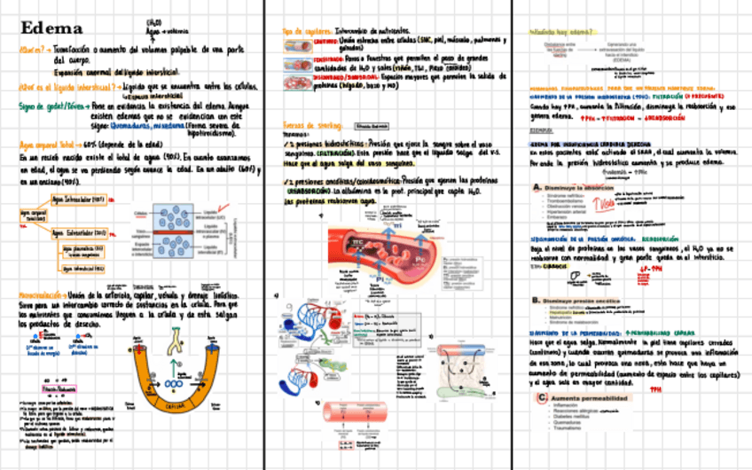 Miniatura del documento Edema.pdf