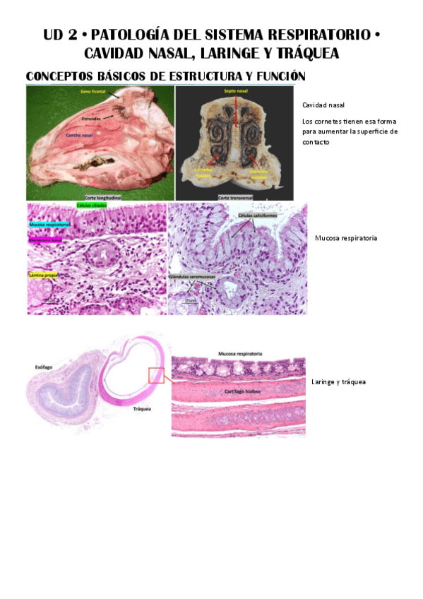 Miniatura del documento UD-2--Patologia-del-Sistema-Respiratorio.pdf
