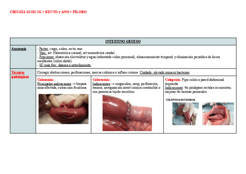 Miniatura del documento tabla-Cirugia-GI-III-IG--Recto-y-ano--piloro.pdf