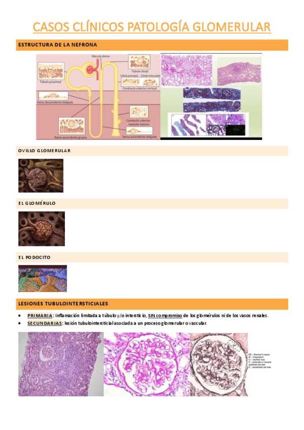 Miniatura del documento casos-clinicos-patologia-glomerular.pdf