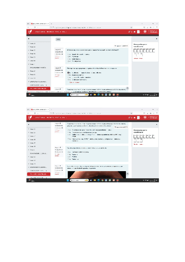 Miniatura del documento Parcial-1-digestivo-alto.docx