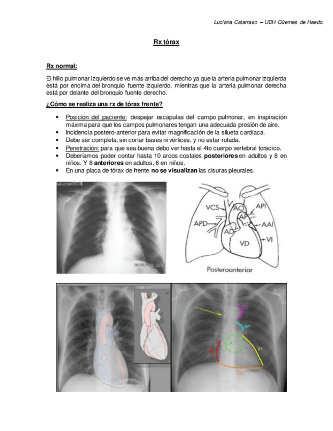Miniatura del documento Rx-torax.pdf