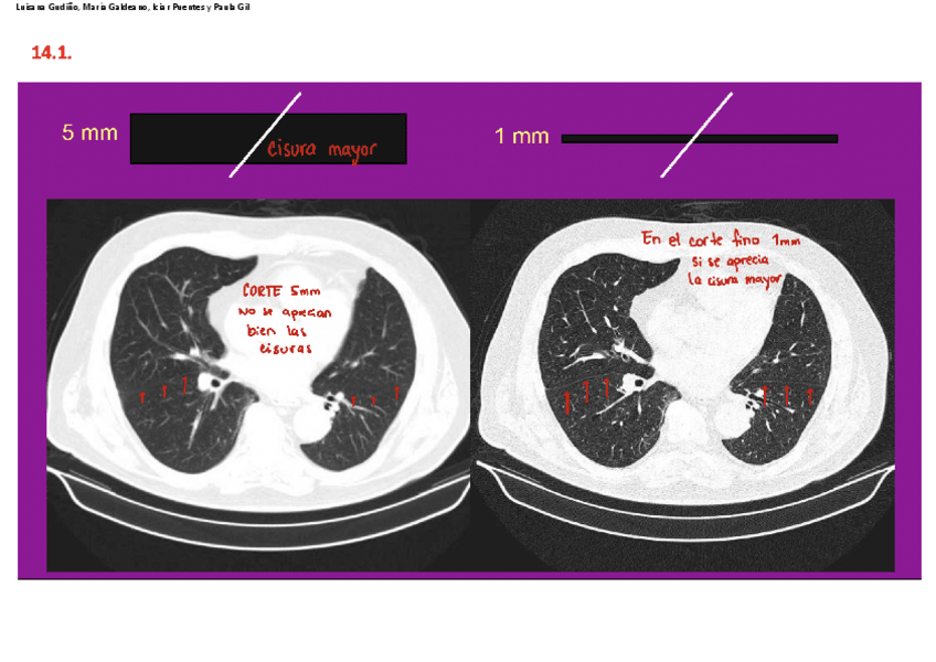 Miniatura del documento ANEXO-T14.pdf