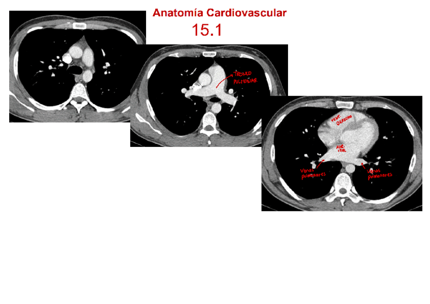 Miniatura del documento ANEXO-T15.pdf