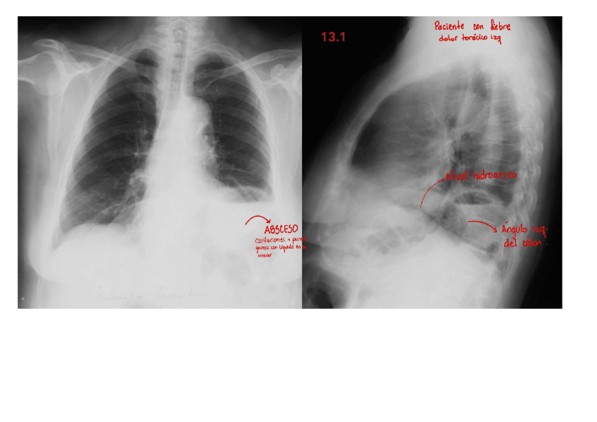 Miniatura del documento ANEXO-T13.pdf