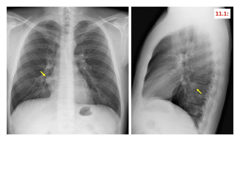 Miniatura del documento ANEXO-T11.pdf