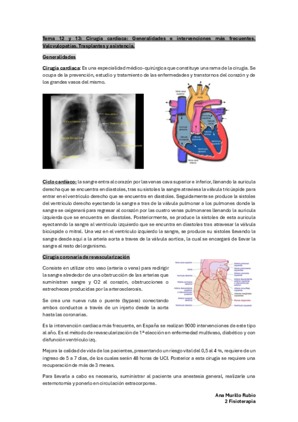 Miniatura del documento Tema-12-y-13-Cirugia-cardiaca-Generalidades-e-intervenciones-mas-frecuentes.-Valvulopatias.-Transplantes.pdf