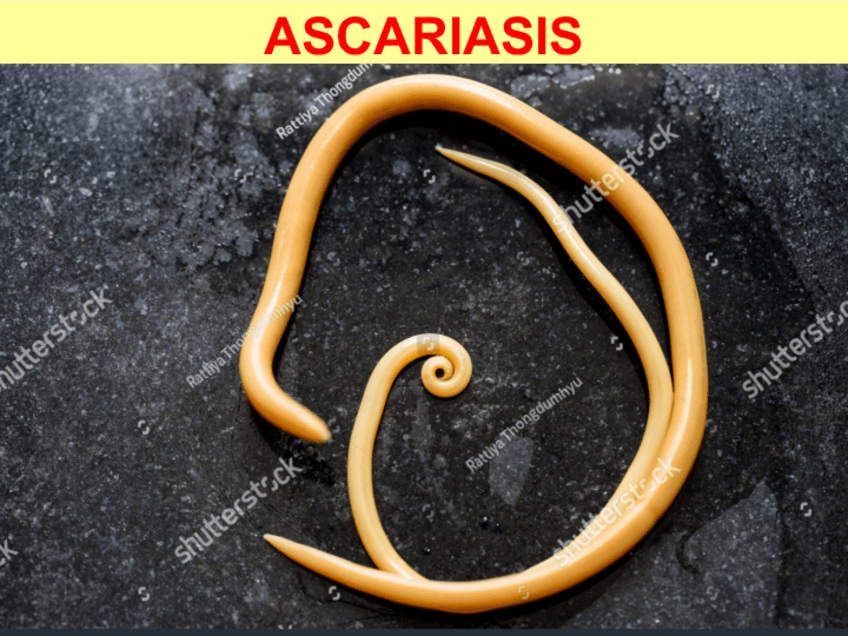 Miniatura del documento TEMA-20-ASCARIASIS.pdf