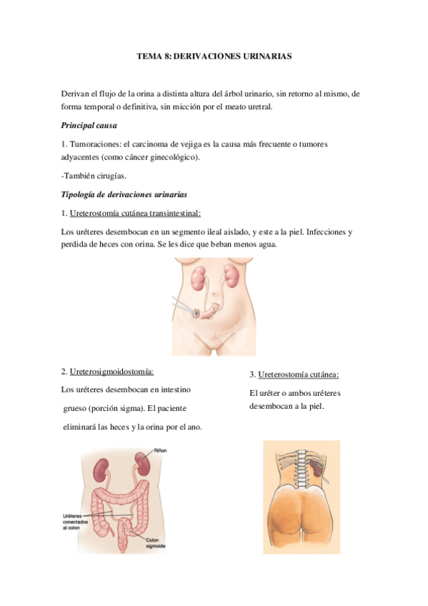 Miniatura del documento TEMA 8 derivaciones urinarias.pdf
