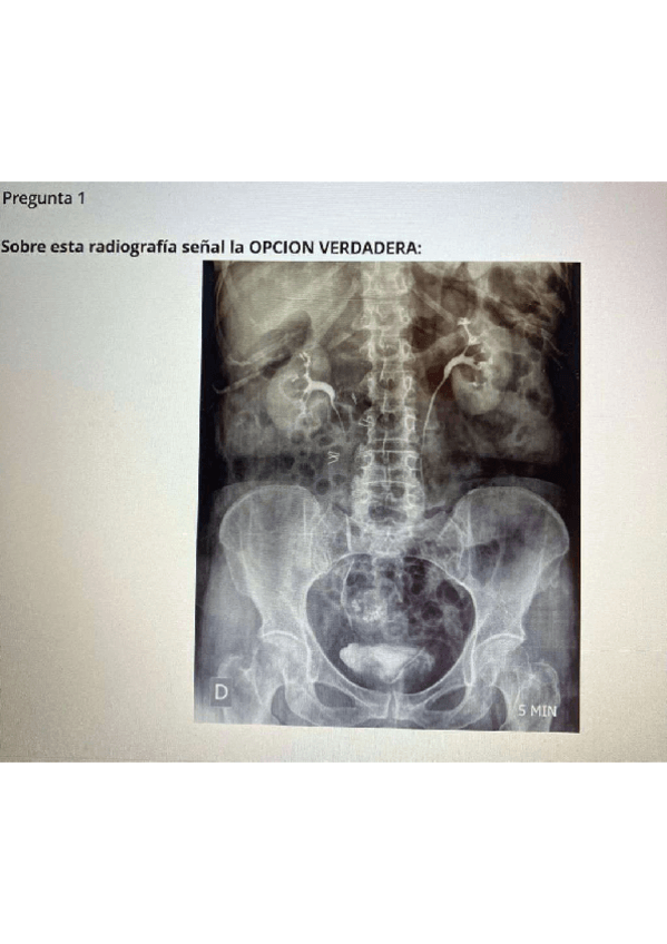 Miniatura del documento Examen-Parcial-2023-24.pdf