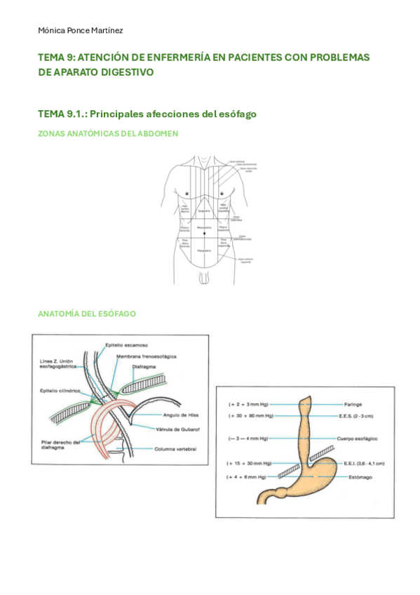 Miniatura del documento Resumenes-tema-9-2PARCIAL.pdf