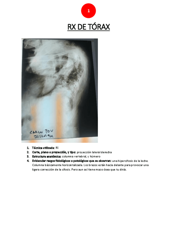Miniatura del documento RX-torax.pdf