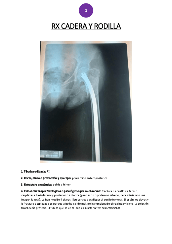 Miniatura del documento RX-cadera-y-rodilla.pdf