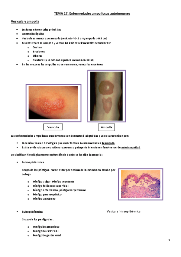 Miniatura del documento Tema 17. Enfermedades ampollosas autoinmunes.pdf