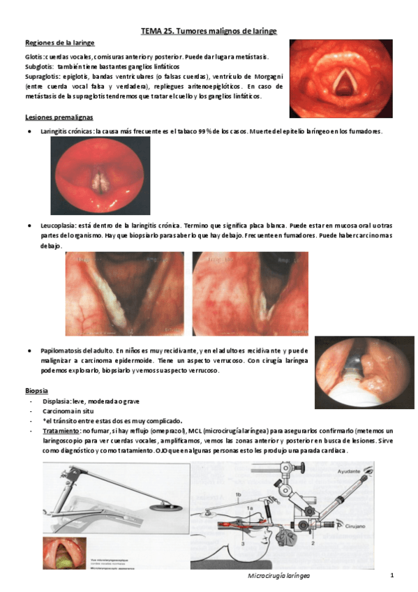 Miniatura del documento Tema 25.Carcinoma de laringe.pdf