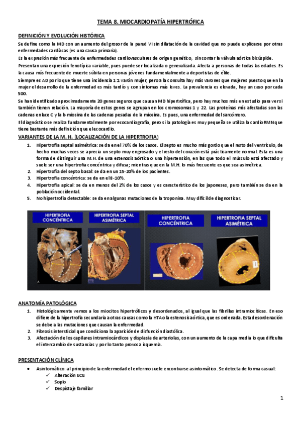 Miniatura del documento Tema 8. Miocardiopatía hipertrófica.pdf