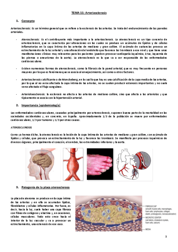 Miniatura del documento Tema 11. Arteriosclerosis.pdf