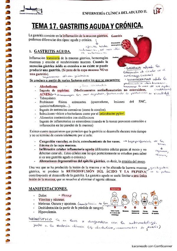 Miniatura del documento TEMA-17-GASTRITIS-AGUDA-Y-CRONICA.pdf