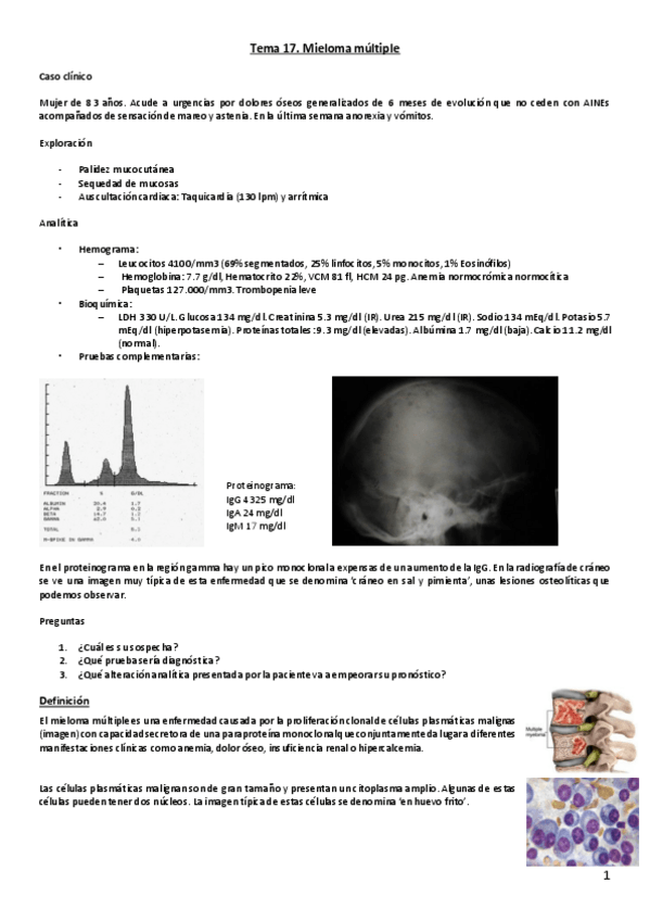 Miniatura del documento Tema 20. Mieloma múltiple.pdf