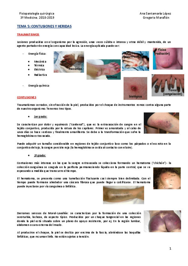 Miniatura del documento Tema 5 - Contusiones y heridas.pdf