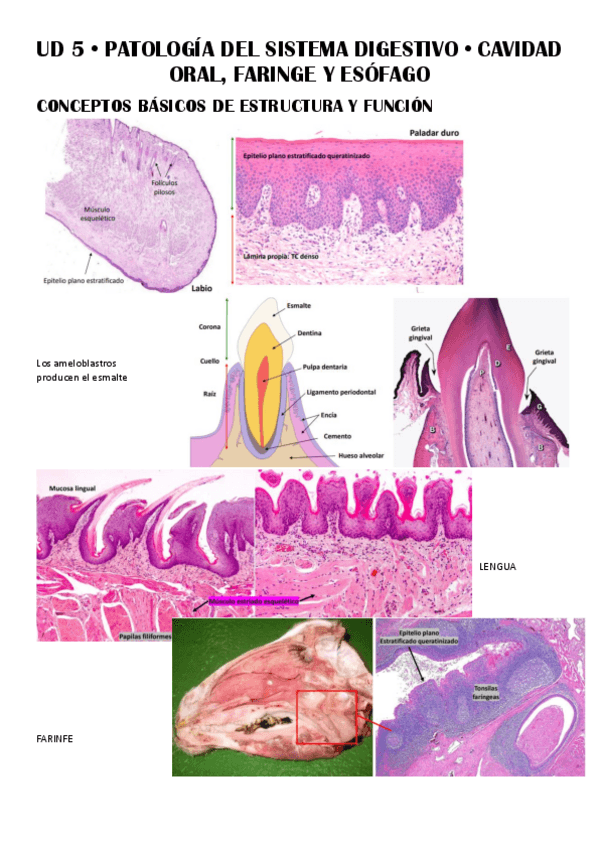Miniatura del documento UD-5--Patologia-del-Sistema-Digestivo.pdf