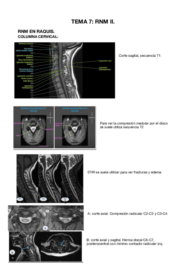 Miniatura del documento Tema-7.-Resumen.pdf