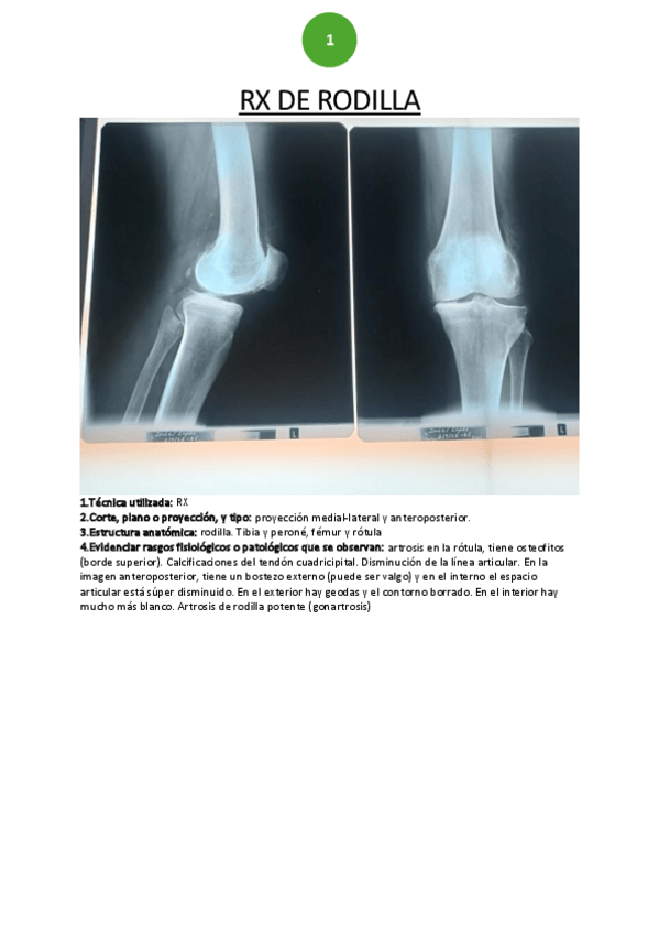 Miniatura del documento RX-rodilla.pdf