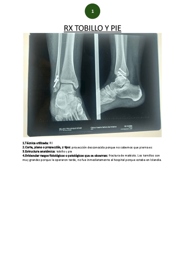 Miniatura del documento RX-tobillo-y-pie.pdf