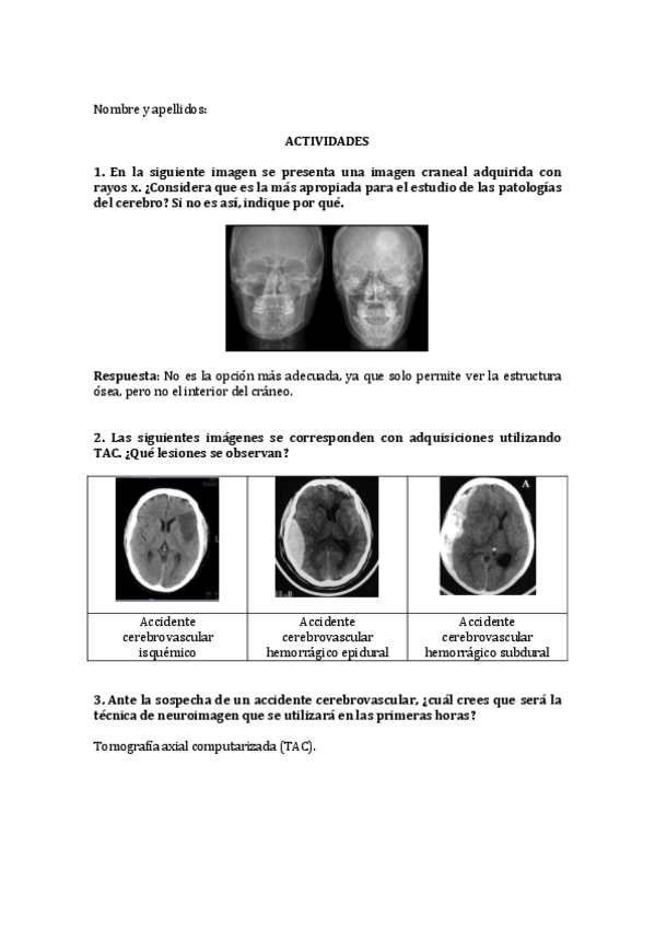 Miniatura del documento Tarea-Neuroimagen.pdf